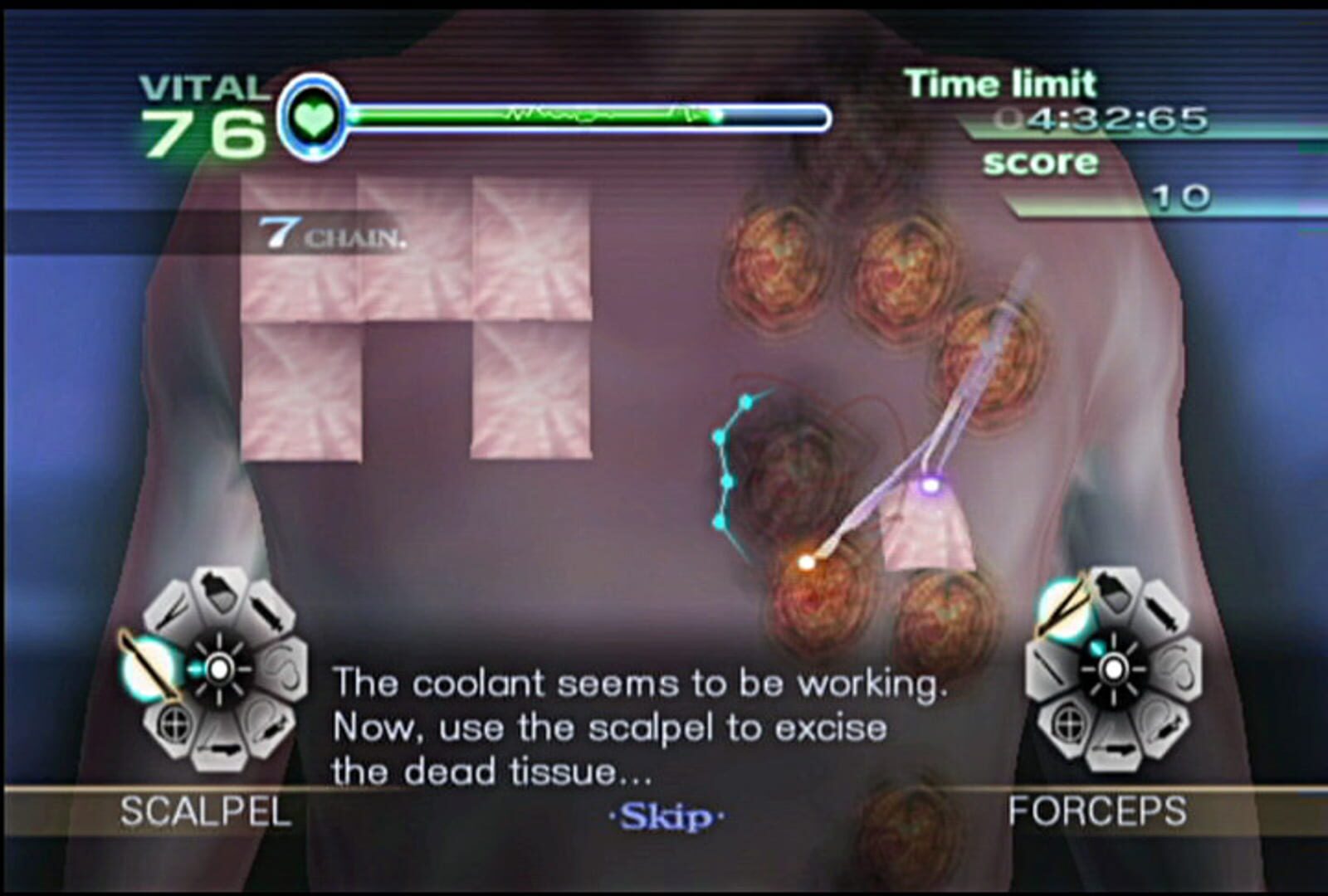 Screenshot for Trauma Center: New Blood