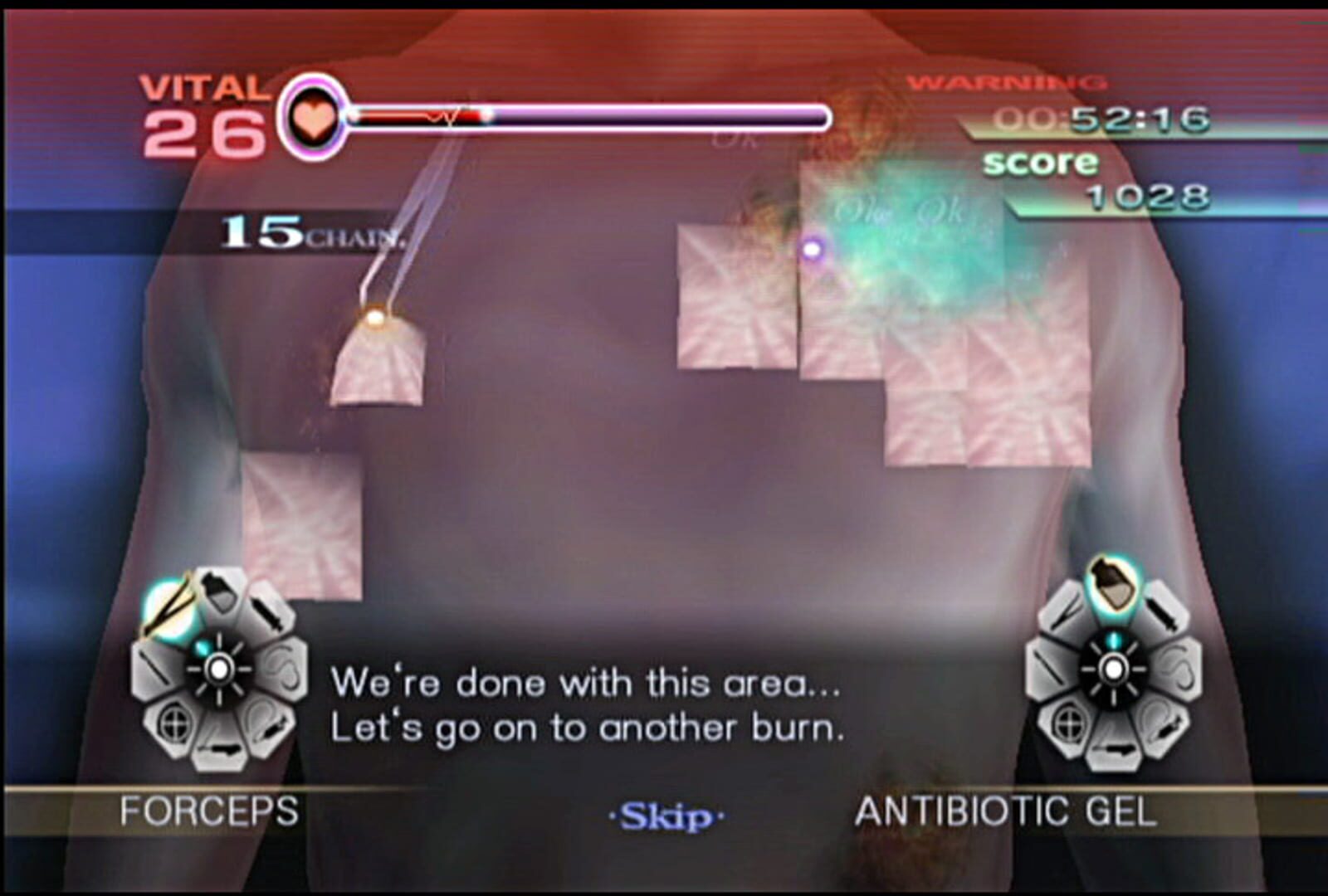 Screenshot for Trauma Center: New Blood