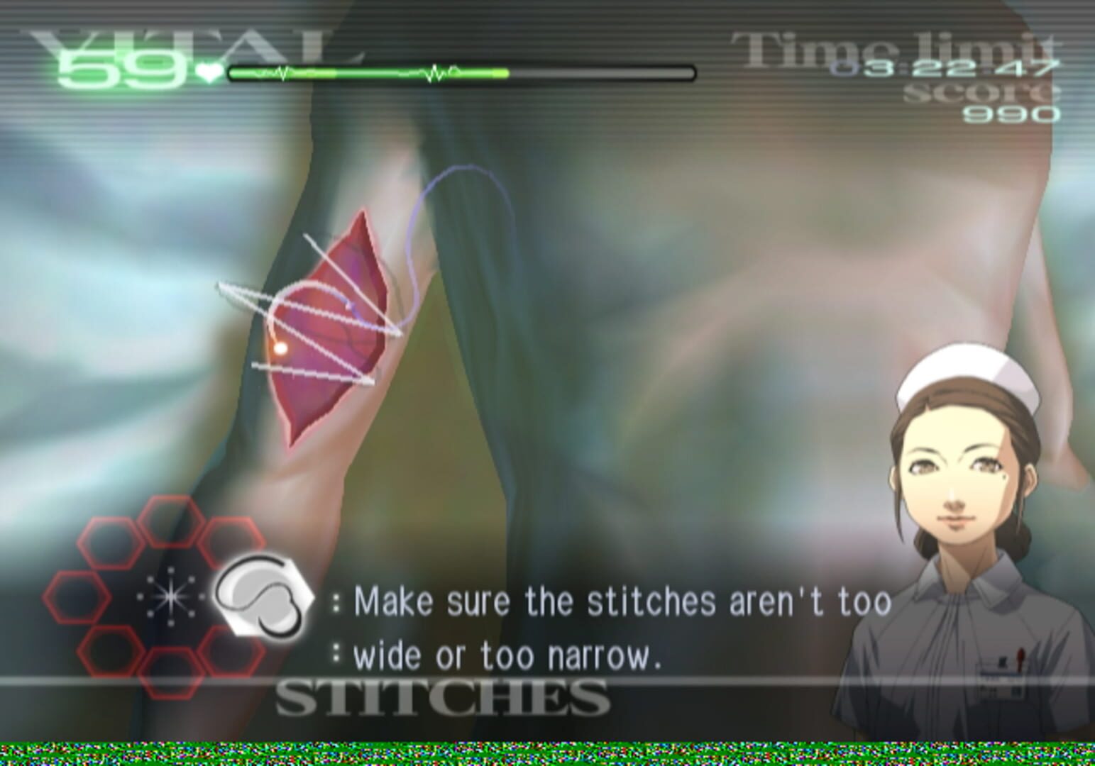 Screenshot for Trauma Center: Second Opinion